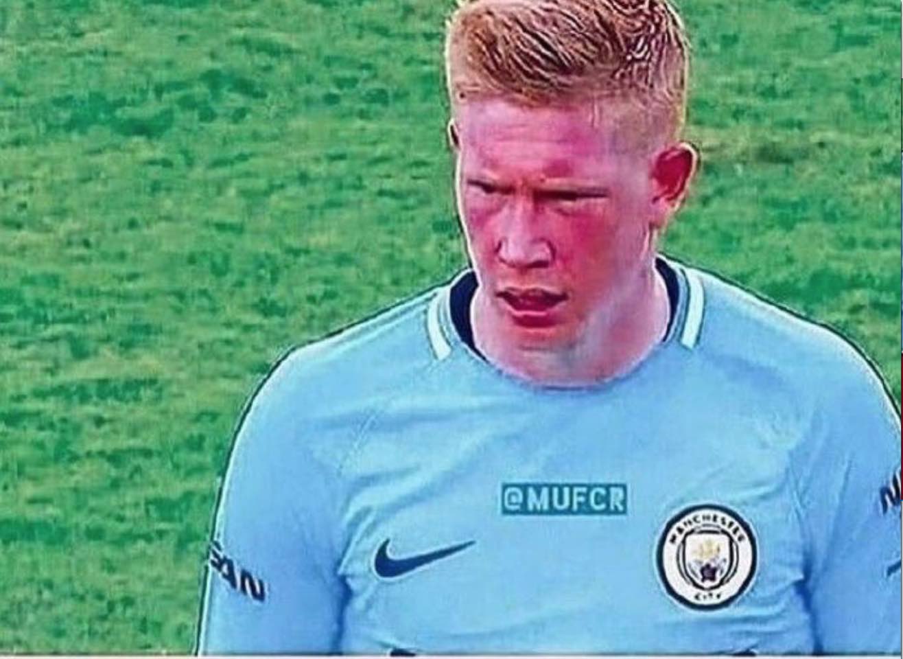 皇马后防问题严重，阿诺德伤缺，球员轮换困难，姆巴佩虽强但后防乏力，形势严峻。